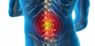 Лечение радикулита в Волгограде «Волжская здравница»