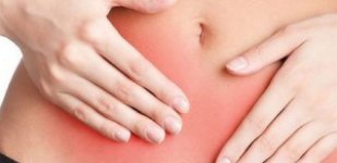 Лечение цервицита