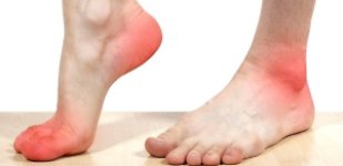 Лечение периферических артерий в Волгограде «Волжская здравница»