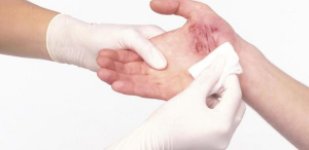 Лечение ран в Волгограде «Волжская здравница»