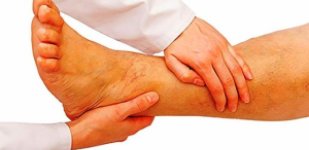 Лечение тромбофлебита вен нижних конечностей в Волгограде «Волжская здравница»