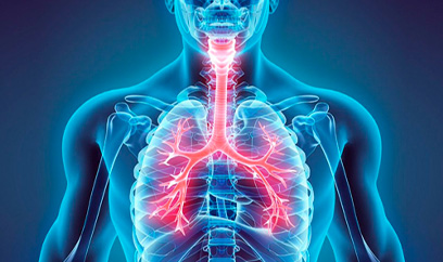 Пневмония COVID