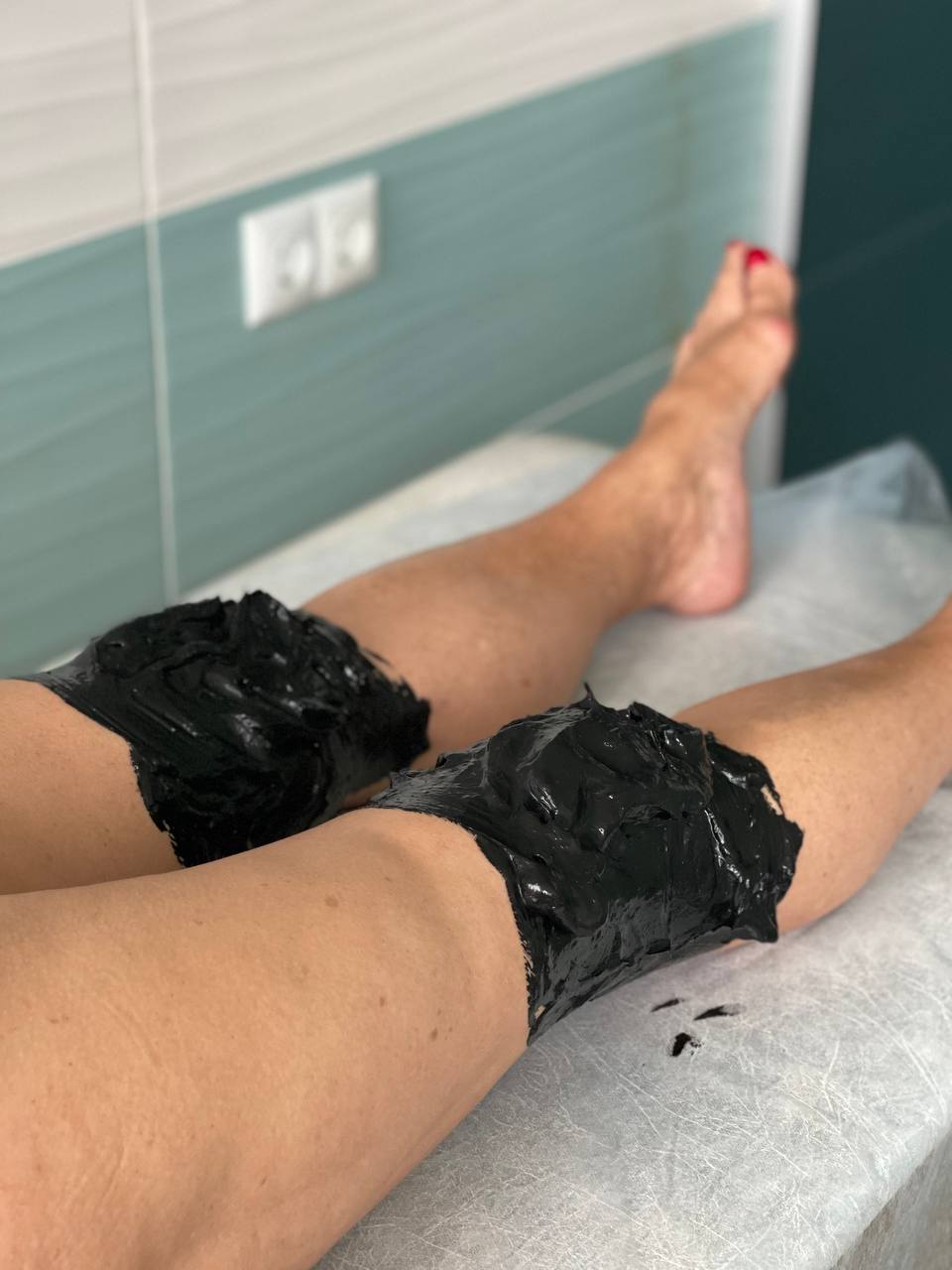 Грязелечение в Волгограде. Пелоидотерапия - лечение грязями